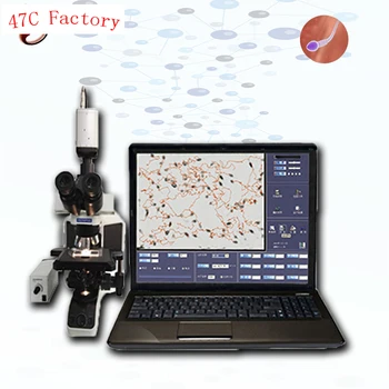 Popüler tıbbi ürün Analiz Cihazları / / Sperm Analizörü (elektron mikroskobu)
